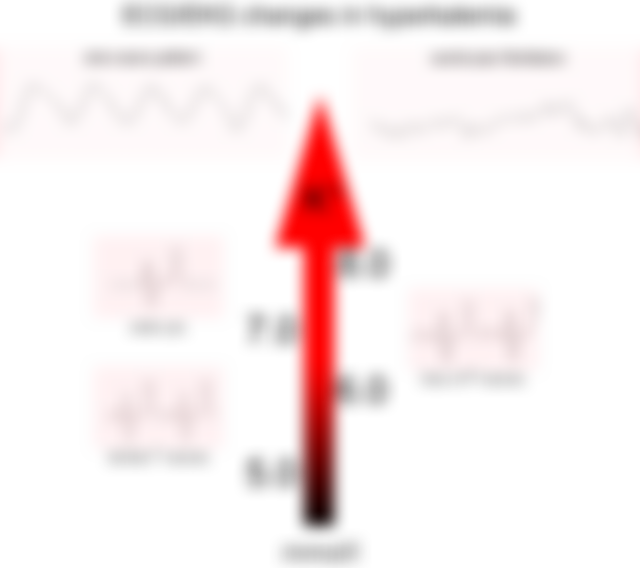 hyperkalemia6.png#s-1035,918