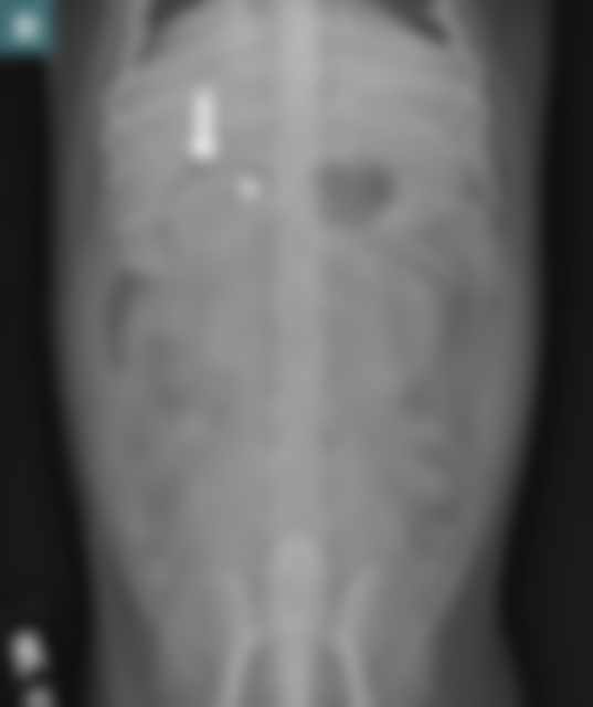 TVP-2020-0102_Pancreatitis_Part-1_Fig-2B.jpg#s-865,1031