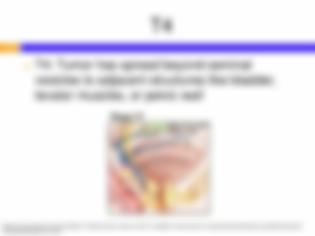 overview-and-pharmacotherapy-of-prostate-cancer-based-on-nccn-2012-guidelines-for-prostate-cancer-26-638.jpg?cb=1424720183#s-638,479